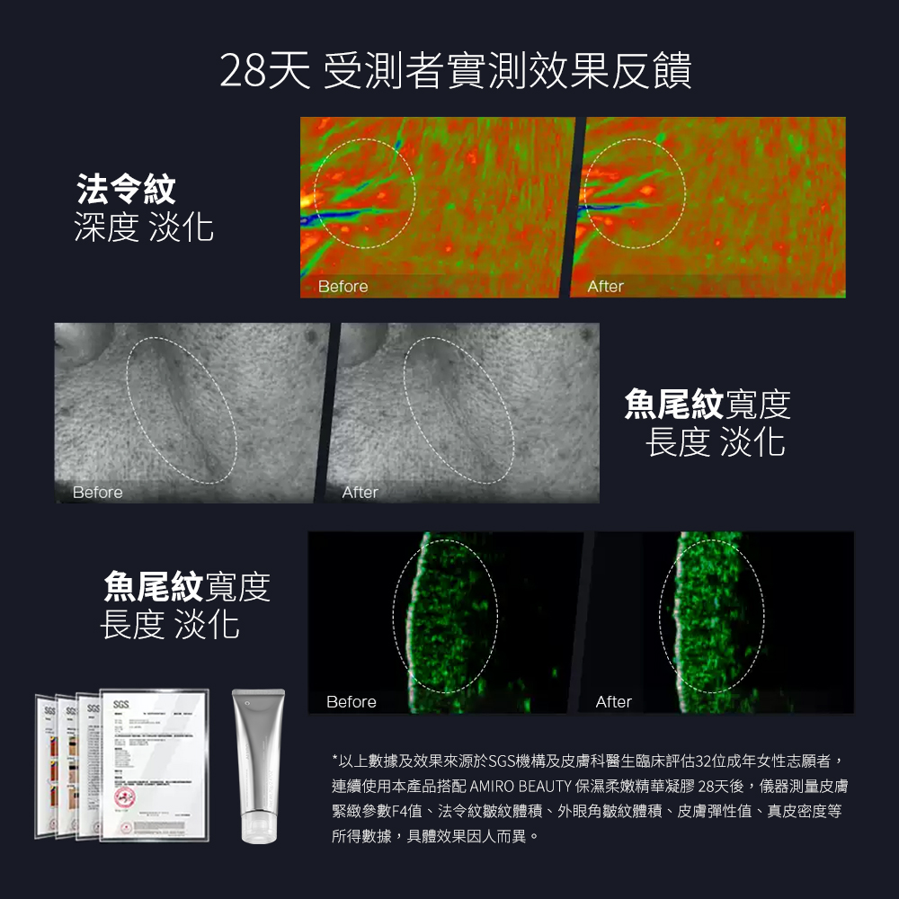 AMIRO 時光機 拉提美容儀R1 PRO
