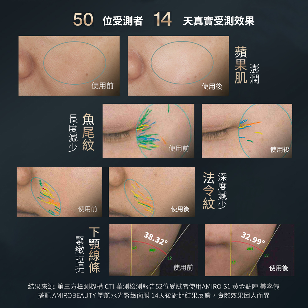 AMIRO S1 黃金點陣美容儀 膠原砲